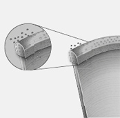 Excessive segment wear in general